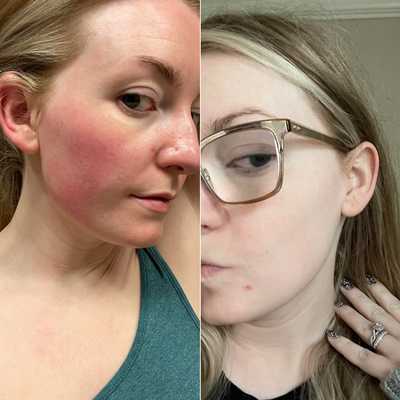 Before and after — Sarah,29