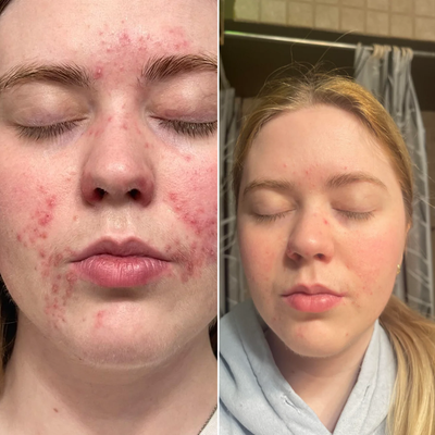 Before and after β Jess,25