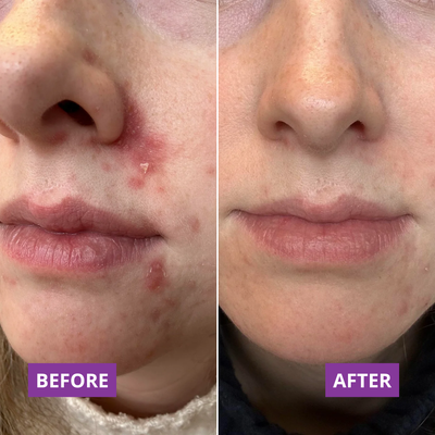 Before and after β Jess,41